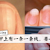 指甲上有一条一条线,要小心了