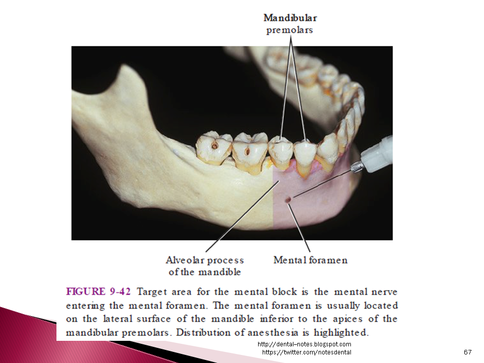 Dental Notes Mental and Incisive Nerve Block NOTES