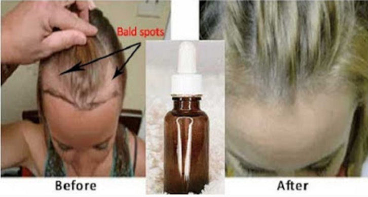 Mejor la máscara para el crecimiento de los cabello el rating