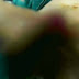 Notícia de homem que teve pênis arrancado em Capim Grosso é mentira