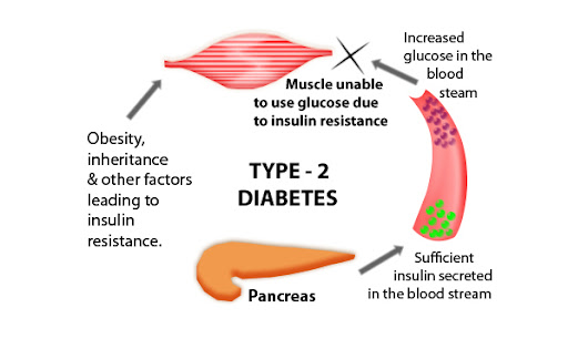 diabetes mellitus symptoms risks and treatment options diabetes mellitus symptoms risks and treatment options