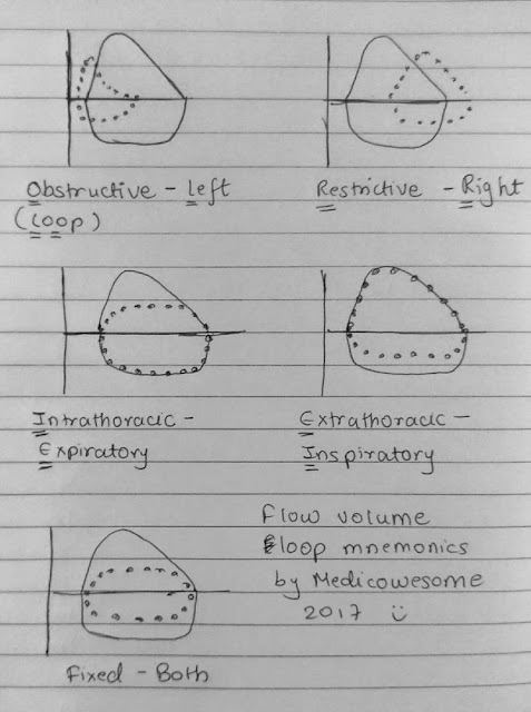 Kyphoscoliosis Flow Volume Loop