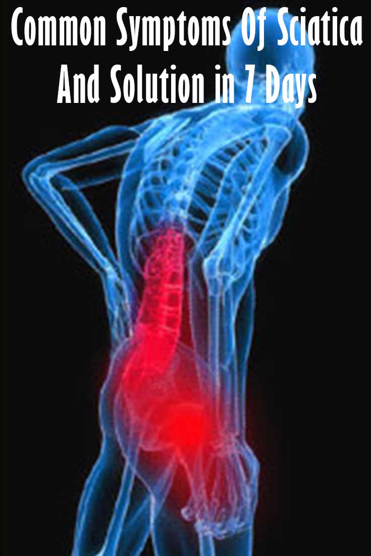 Proven Exercises and Treatment to help remedy sciatica in 7 Days