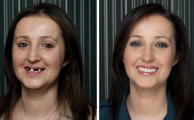 Dr. Elzbieta Basil's Dental Blog Five Things You Should Know About