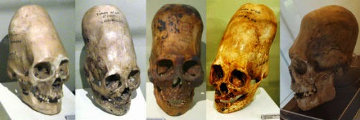 Cráneos Paracas