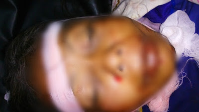 Warga Pituruh Jadi Korban Tabrak Lari, Pelaku Belum Diketahui