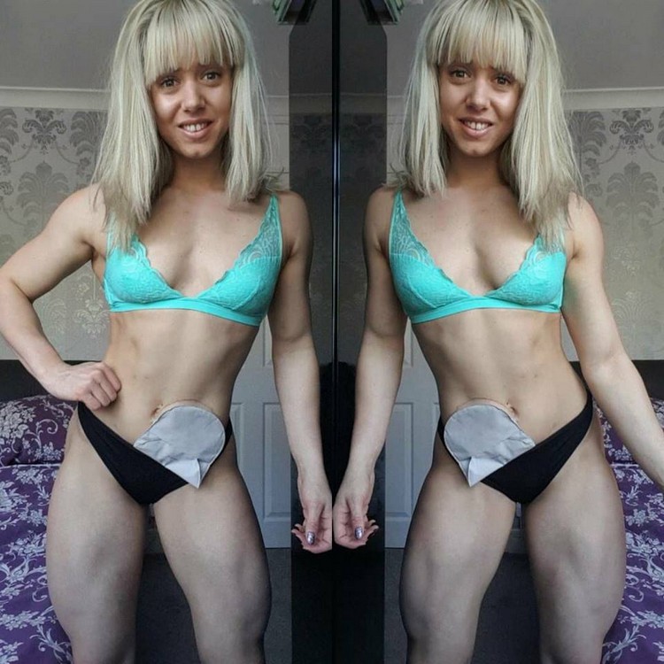 Zoey Wright - Her chronic illness transforms it into bodybuilder Zoey Wright - Her chronic illness transforms it into bodybuilder