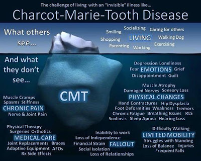 sensibilisation sur la maladie de Charcot-Marie-Tooth (CMT)