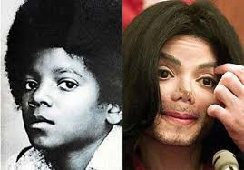 Michael Jackson as a boy and later as an adult