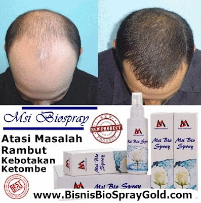 Testimoni MSI Bio Spray - Multy Spray Testimoni MSI Bio Spray, Testimoni MSI Multy Spray