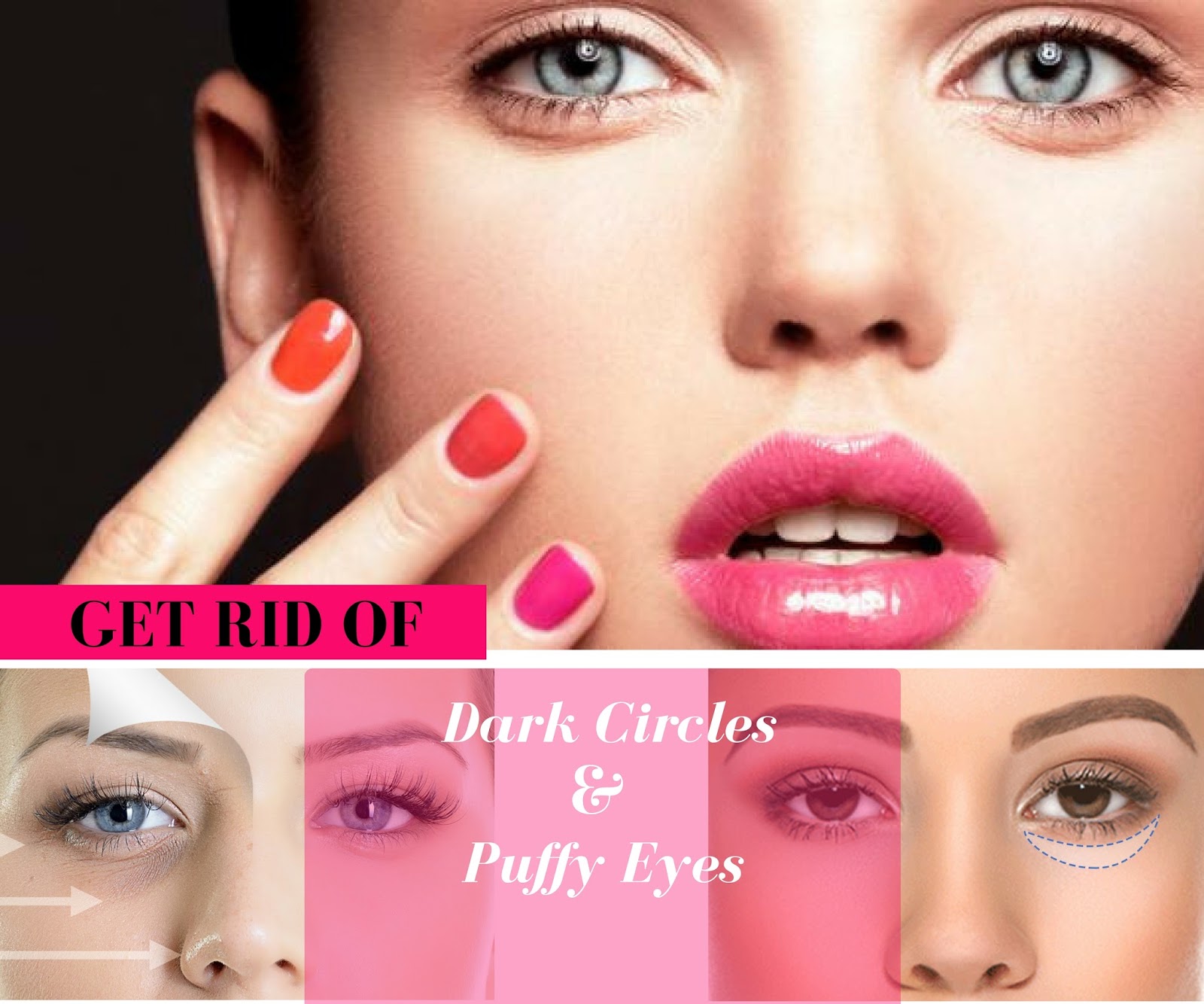 Korean Plastic Surgery for Dark Circles and Puffy Eyes My Plastic