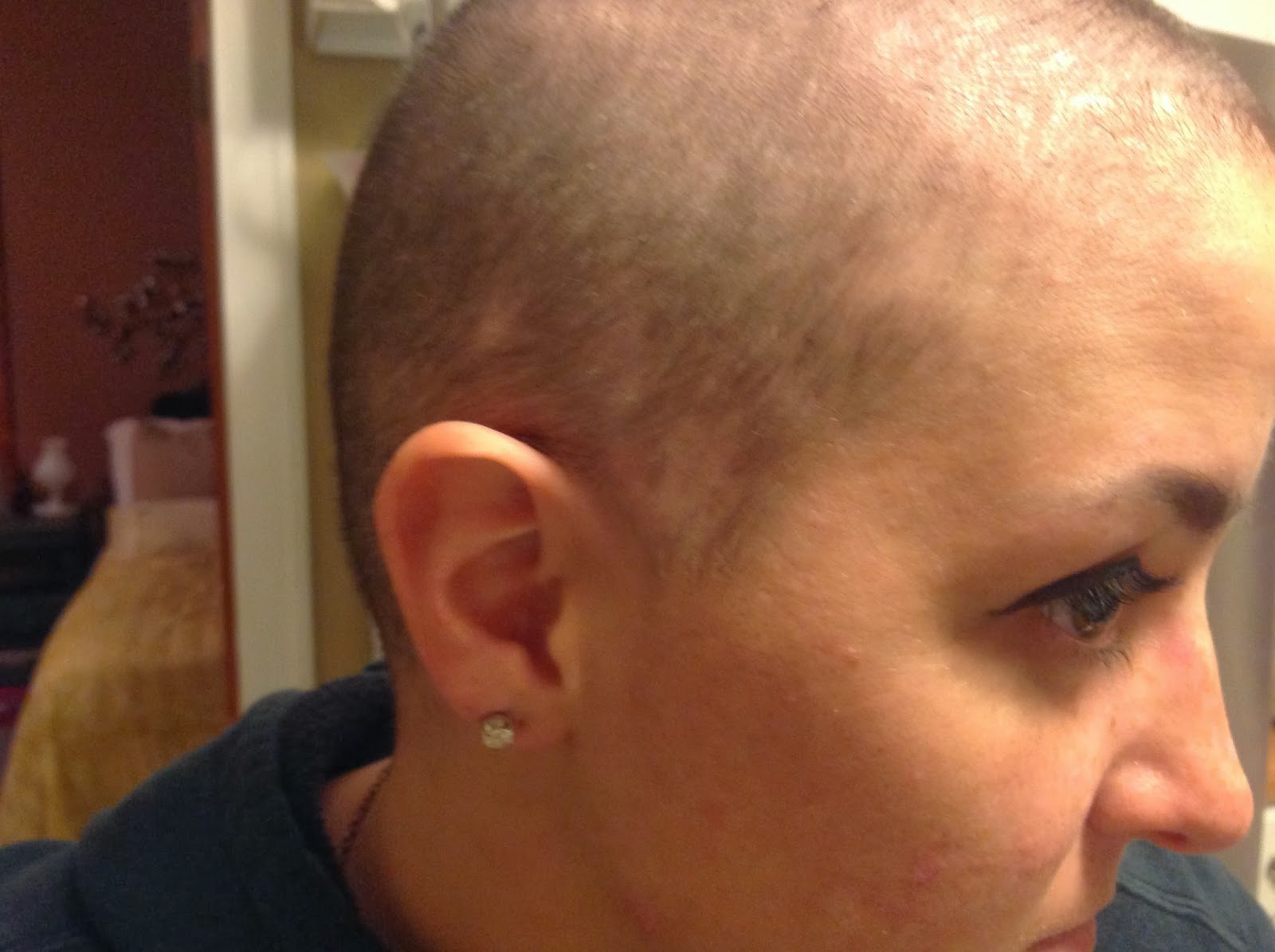 Carri Us Home Chemo 2 & I'm Losing My Mind...and My Hair!