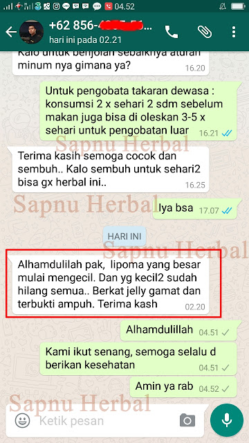 Obat Bengkak di Selangkangan Sebelah Kanan / Kiri Yang Manjur