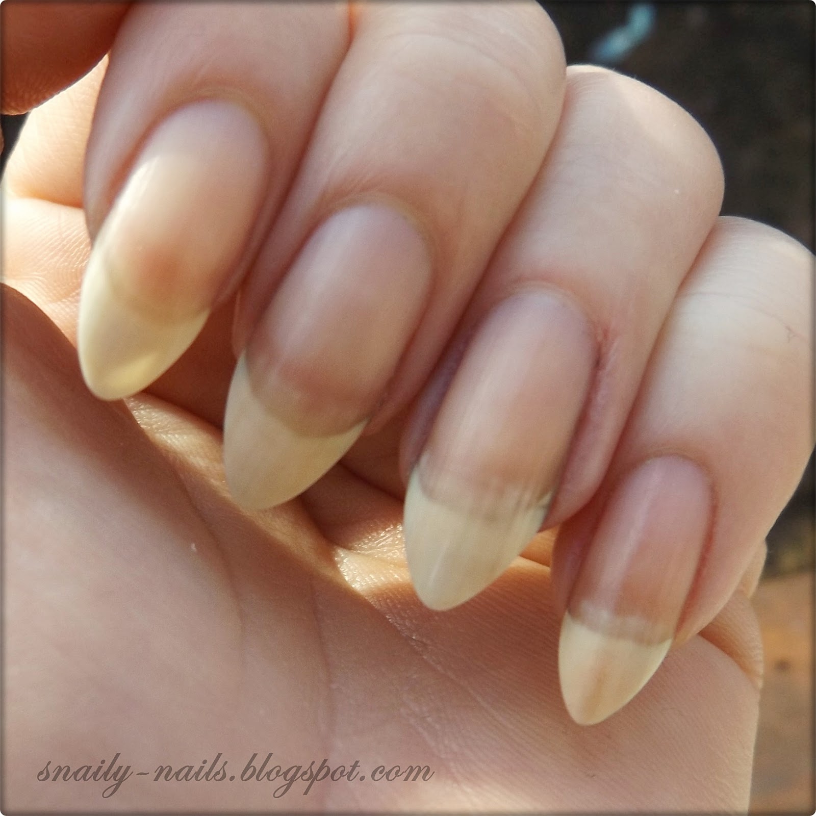 Onycholiza Moja Przygoda Czesc 2 Snaily