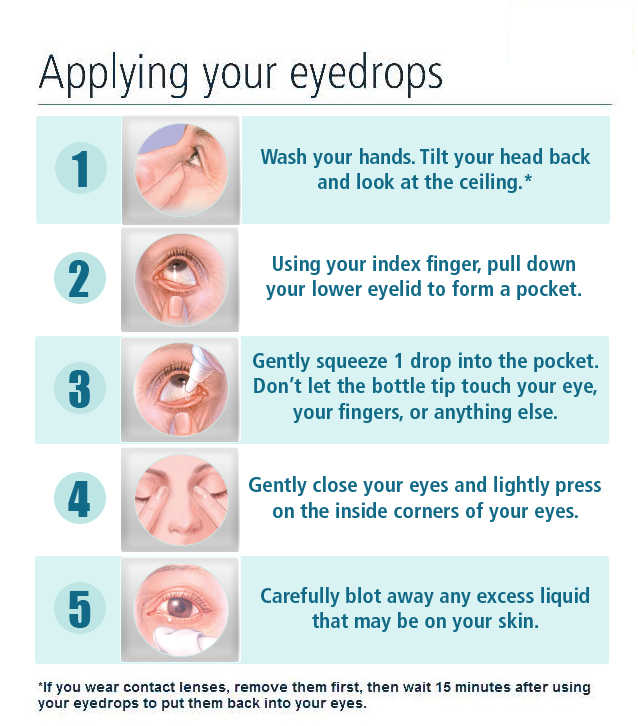 Apoteker Peduli Cara Menggunakan Obat Tetes Mata Pada Dewasa Dan Anak Anak Apoteker Peduli Cara Menggunakan Obat Tetes Mata Pada Dewasa Dan Anak Anak
