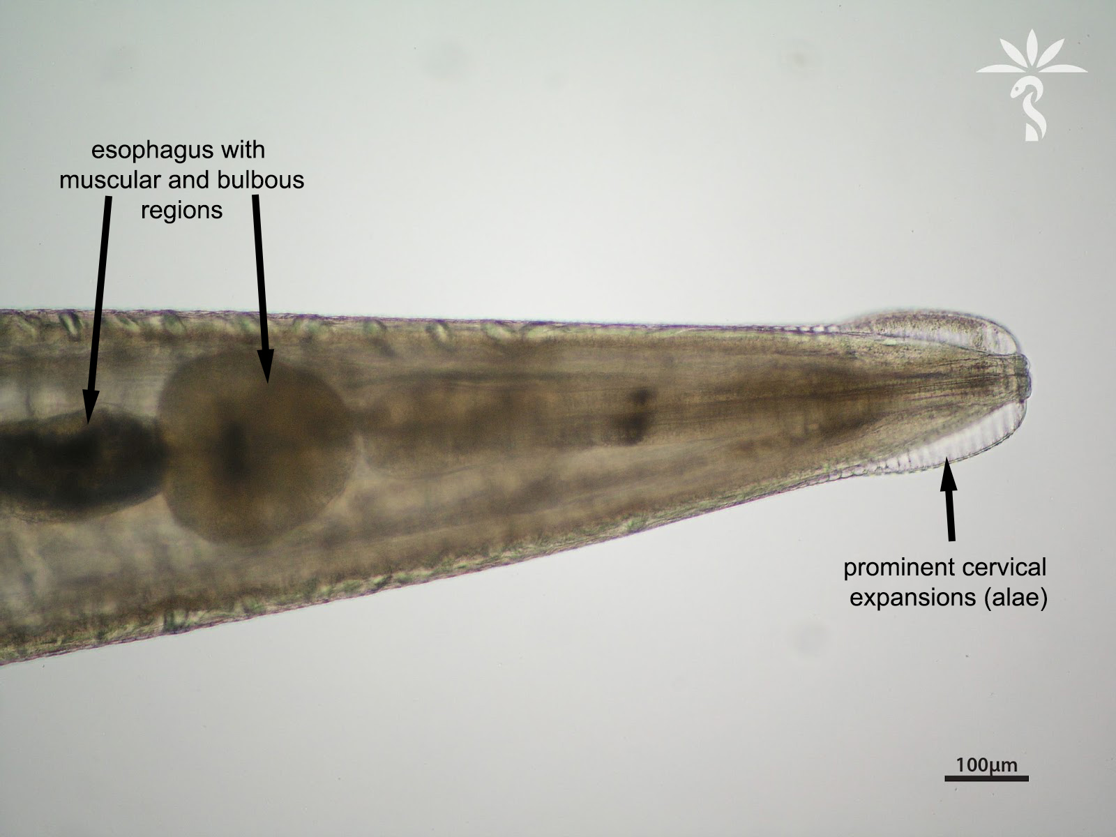 enterobius vermicularis haha