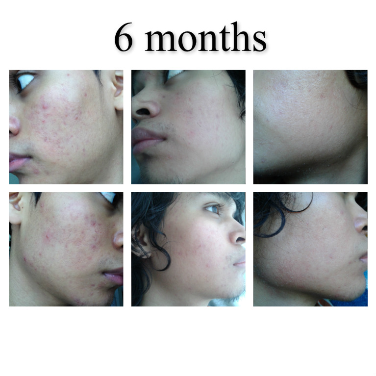 Makeup Artist's Choice Before/After Pics and Testimonials