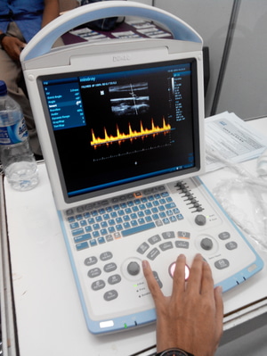 Distributor Alat USG Sederhana Mindray Dp 10 Doppler Distributor-alat-usg-terbaik-mindray-dp-10-doppler