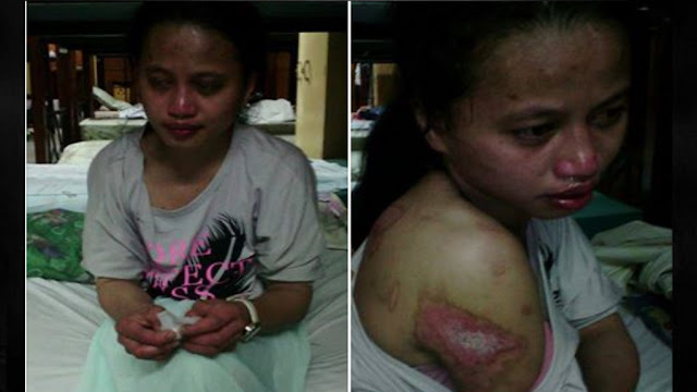 OFW Returns Home After Being Tortured by Employer in Kuwait