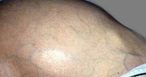 DEFANS MUSCULAR ADALAH EPUB DEFANS MUSCULAR ADALAH EPUB