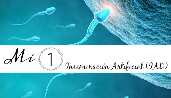 Mi primera inseminación artificial (IAD)