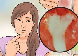 Obat Tradisional Infeksi Saluran Kencing Pada Wanita Obat Tradisional Infeksi Saluran Kencing Pada Wanita