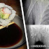 ATENCIÓN! Este Hombre Por Comer SUSHI 3 Veces Por Semana Su Cuerpo Se Lleno De ....