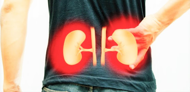 Solve Kidney Problem Solve Kidney Problem