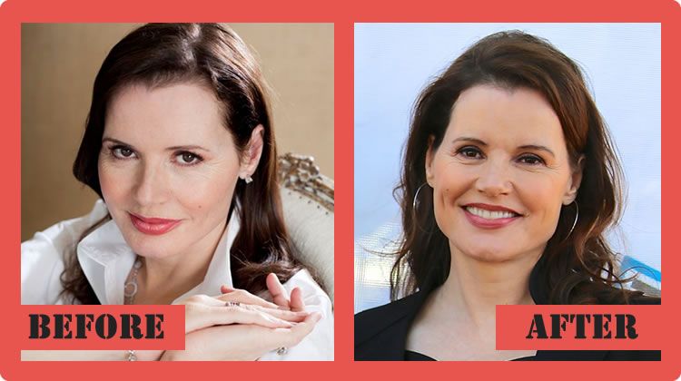 Geena-Davis-Plastic-Surgery-Before-And-After%2B%25281%2529.jpg