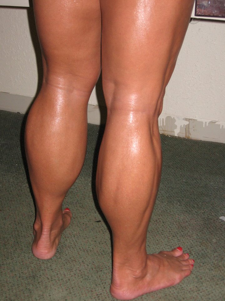 опухают икры ног что делать. опухают икры ног что делать. мускулар легс.