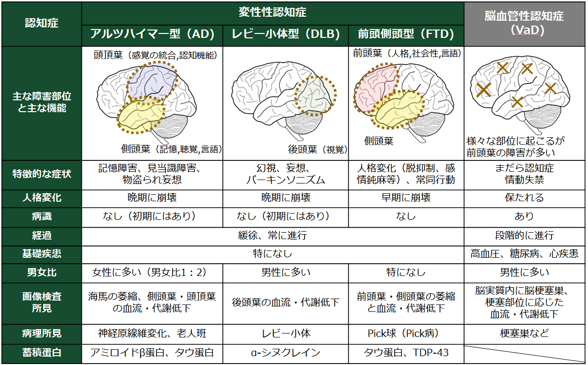 脳を使う運動で認知症を防ぎたい 健康マスターに俺はなる！