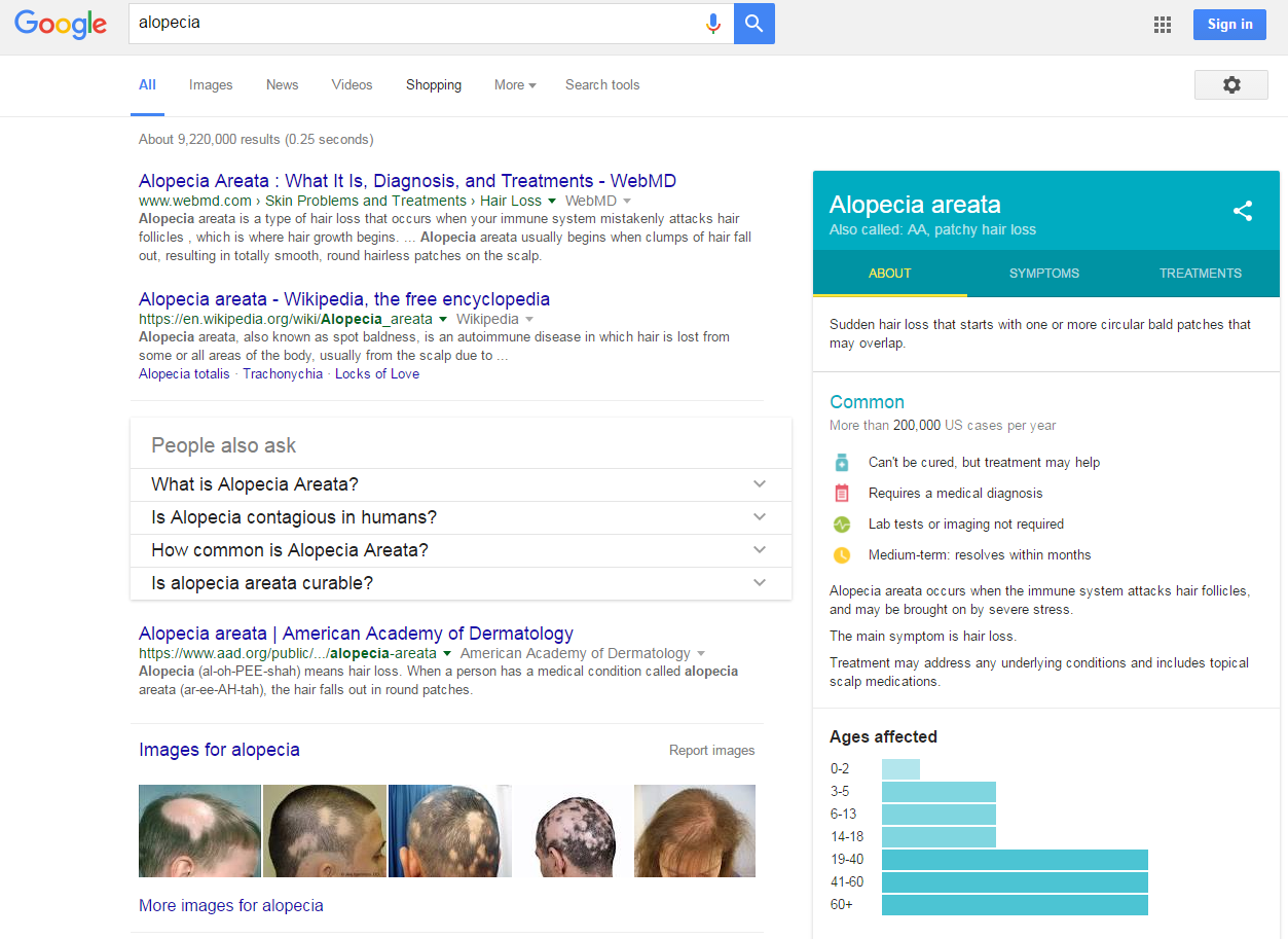 alopecia.PNG