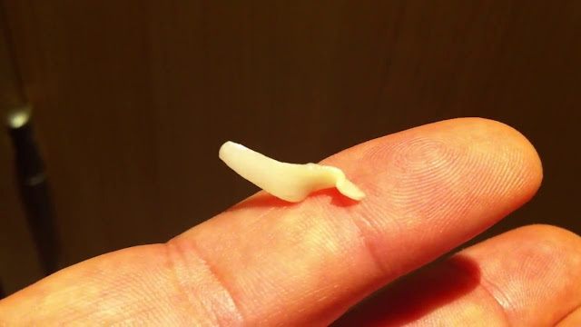 Tapeworms do cão