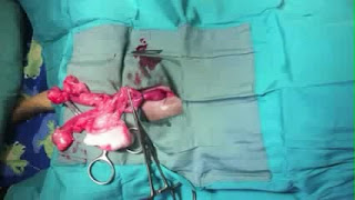 Teknik Operasi Ovariohisterectomy, Hysterectomy dan Hysterotomy (Bedah Genital)