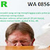 Penyakit Wasir Internal dan Wasir Eksternal thumbnail