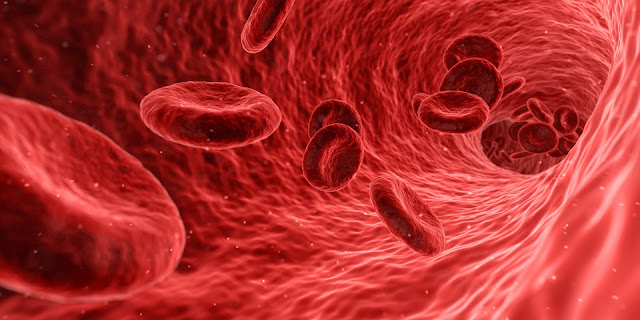 Anemia Mengenal Apa Itu Anemia, Jenis, dan Penyebab