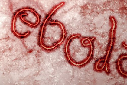 Powerful Ways to Prevent Ebola Virus