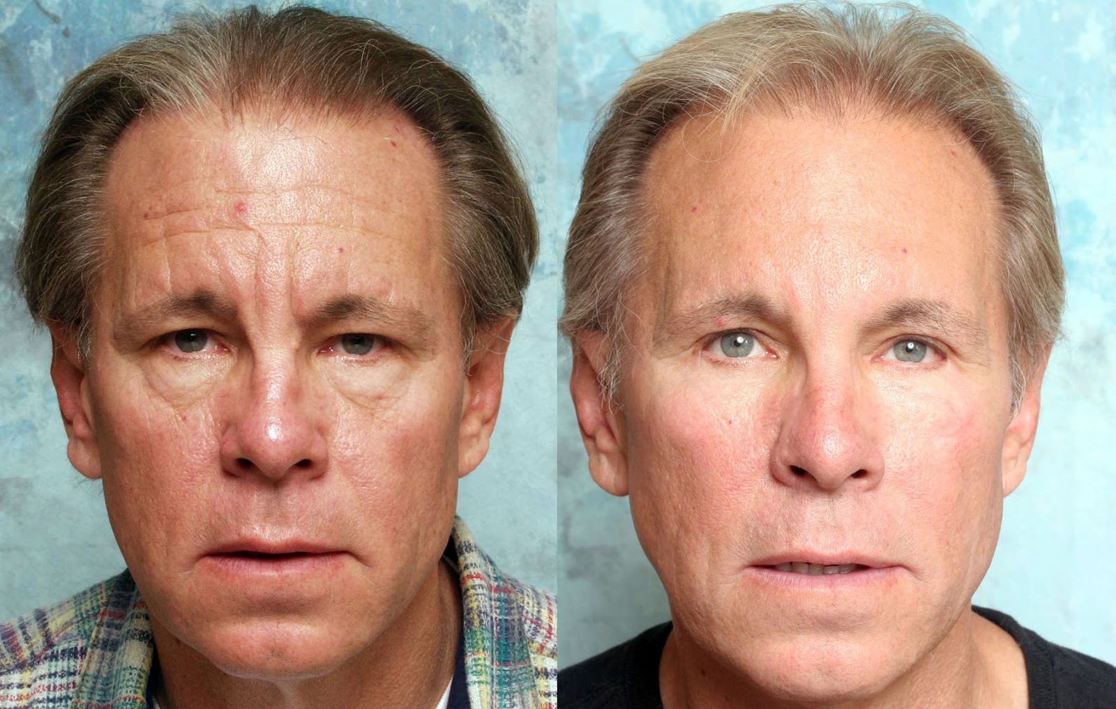 Facial Exercises To Look Younger Do Facial Toning Workouts Work For  facial-exercises-to-look-younger-do-facial-toning-workouts-work-for