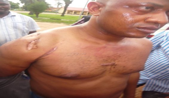 5551712 p1090356 jpeg062db09509f1a877ab6b7356fb15ba80 Check out the gunshot scar kidnapper Evans got after a 2006 Lagos robbery (Photo)