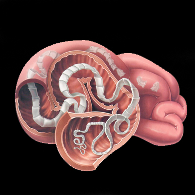 Image result for tapeworms blogspot.com