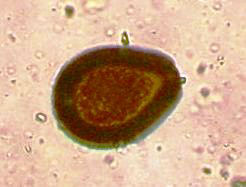 Close up image of the parasite Emac