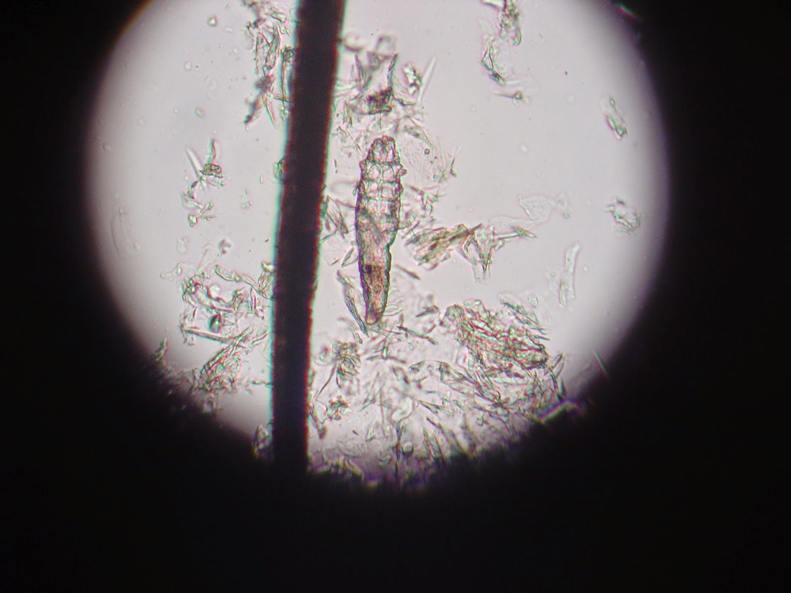 Demodectic Mange