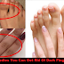 Using These 4 Natural Remedies You Can Get Rid Of Dark Finger Joints Fast!