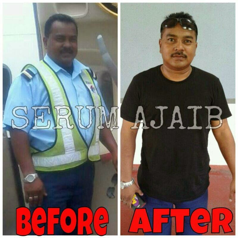 Testimoni L'arome Slimming Serum Testimoni L'arome Slimming Serum