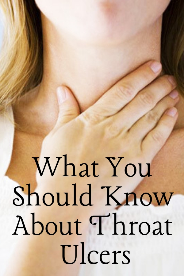 What You Should Know About Throat Ulcers