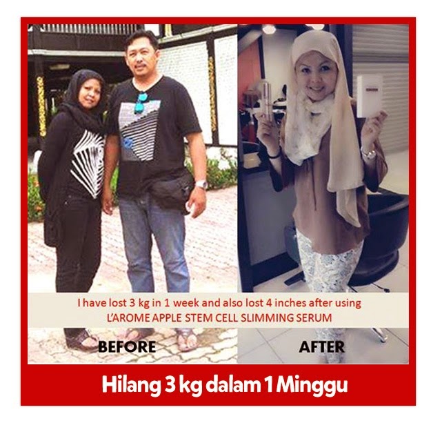 Testimoni L'arome Slimming Serum Testimoni L'arome Slimming Serum