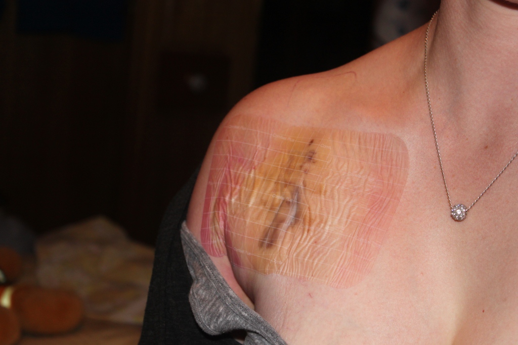 The Teensy, Tiny, Insignificant Details: Upgrading Your Pacemaker ...