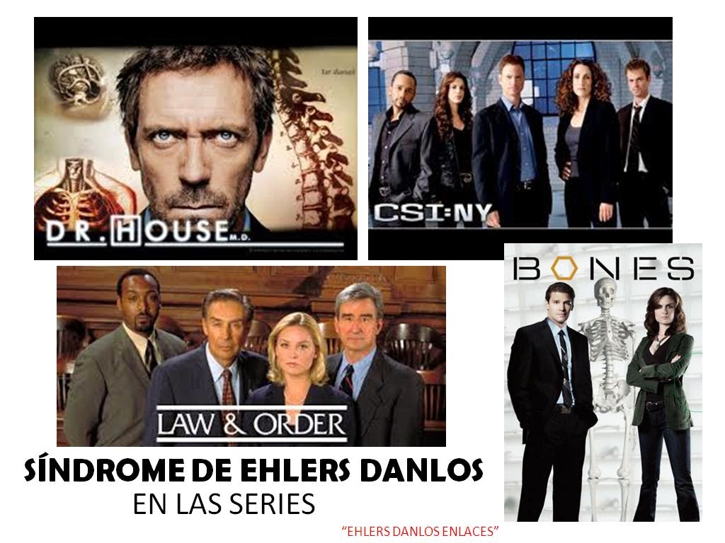 EHLERS DANLOS "ENLACES" Argentina SERIES DE TV Y EHLERS DANLOS