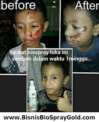 Testimoni MSI Bio Spray - Multy Spray Testimoni MSI Bio Spray, Testimoni MSI Multy Spray