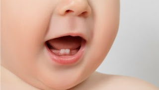 5 Penyebab Pertumbuhan Gigi Pada Bayi Terhambat 5 Penyebab Pertumbuhan Gigi Pada Bayi Terhambat